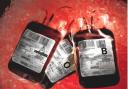 Around 3000 patients in Scotland are believed to have been treated with contaminated blood and blood products