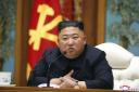 North Korean leader Kim Jong Un is believed to have gout