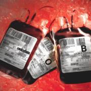 Around 3000 patients in Scotland are believed to have been treated with contaminated blood and blood products