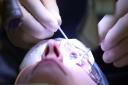 Demand for laser eye surgery boosts revenues and profits at Optical Express