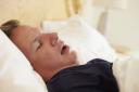 Snoring can be very problematic .. . see 