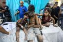 Palestinian children injured in Israeli air raids arrive at Nasser Medical Hospital on October 25 in Khan Yunis, Gaza