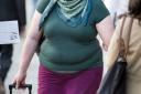 Obesity set to overtake smoking as leading cancer cause