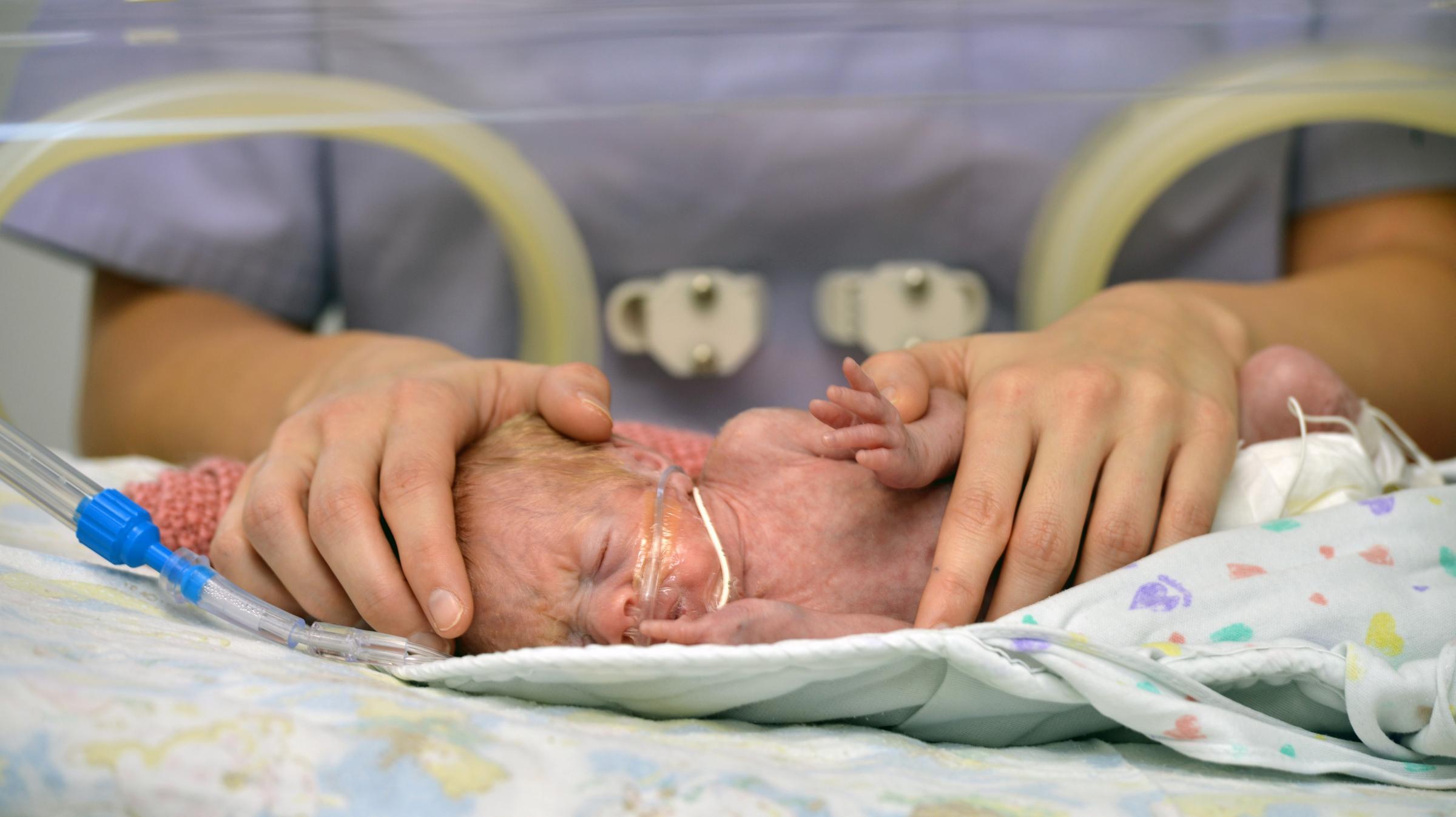 18 Säuglinge innerhalb von vier Wochen nach der Geburt gestorben! Schottische Regierung kündigt an, dass die Häufung von Todesfällen bei Neugeborenen untersucht werden soll.