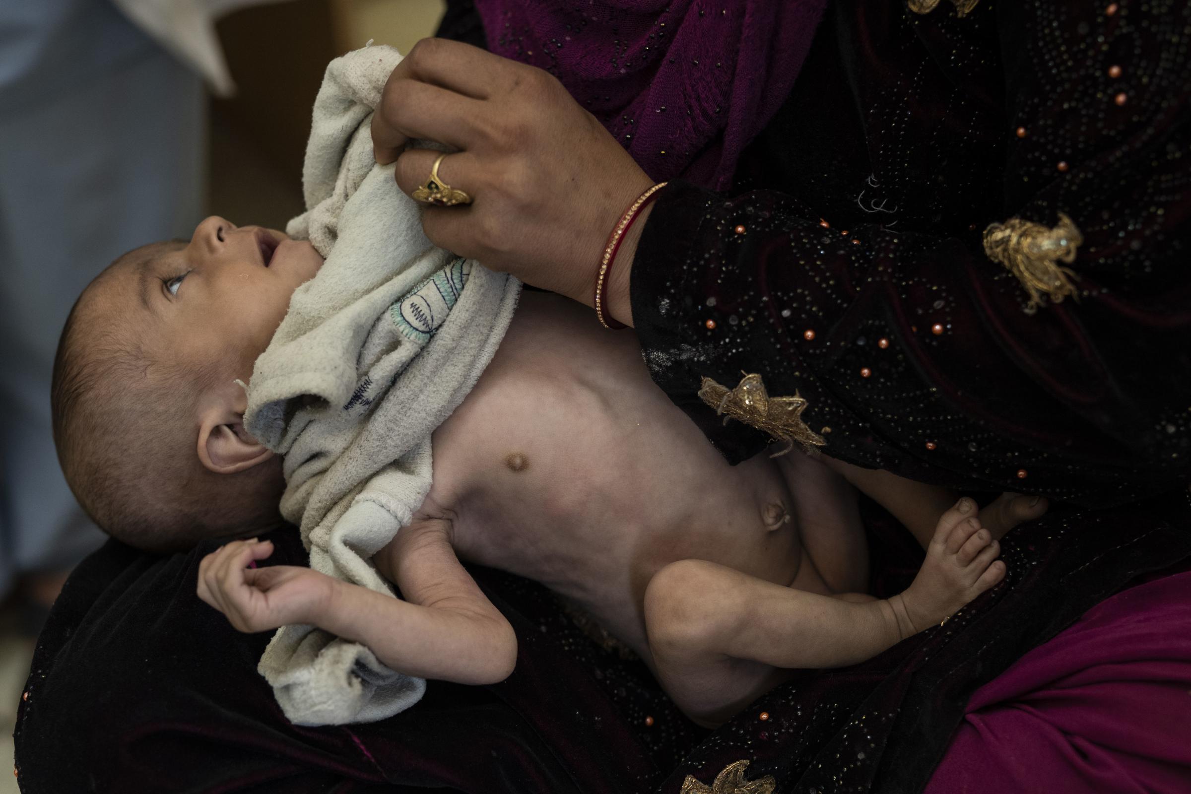 Saliha holds her four-month-old baby Najeeb as he undergoes treatment at the malnutrition ward of the Indira Gandhi Childrens Hospital in Kabul, Afghanistan.