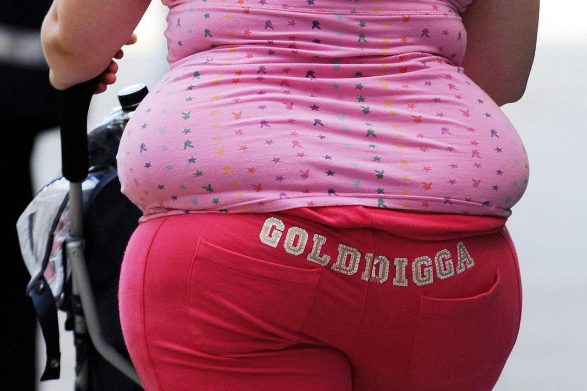 Issue of the day: Should the term 'obesity' be banned?