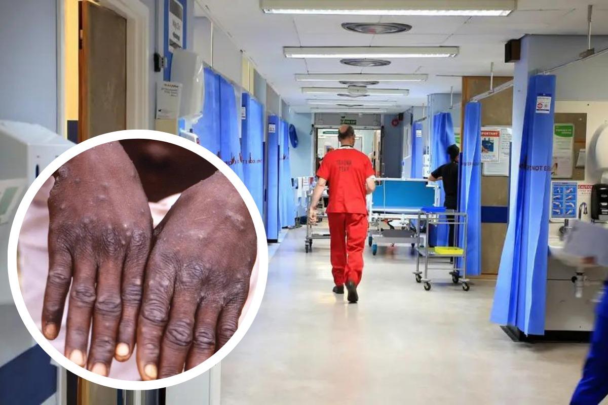The patient identified with monkeypox in Scotland has been isolated and their contacts are being traced