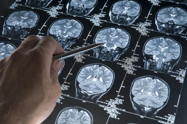 HeraldScotland: Glasgow hosts the Organisation of Human Brain Mapping conference this week