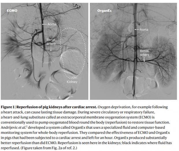 HeraldScotland: Images show organ repair post-mortem using OrganEx versus ECMO, an existing form of perfusion technology (Source: Nature)