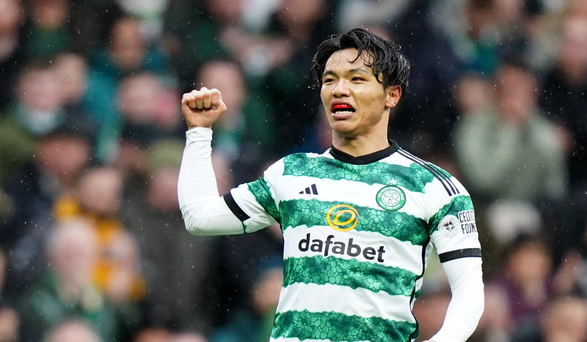 Celtic 3 Kilmarnock 1: Instant reaction to the burning issues