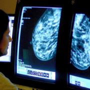 Breast cancer drug accepted for use on NHS in Scotland