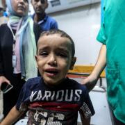 A bewildered Palestinian child receives treatment after Israeli air raids at Nasser Medical