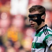 Celtic right back Alistair Johnston wearing a protective face mask in the cinch Premiership game against Motherwell at Fir Park last month