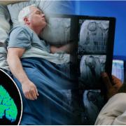 Changes in sleep patterns are common in people with dementia